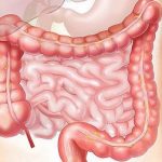 ミヤネ屋で紹介の腸特集。体の不調は腸内細菌やIBS・SIBOが原因？その対策FODMAPとは？