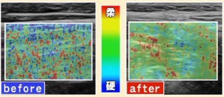 金スマ紹介 動かないゼロトレ のやり方 1回3分で肩こり 腰痛を解消 科学的に検証