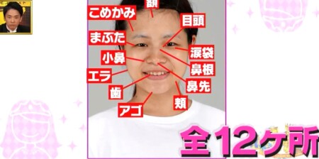 整形シンデレラ1位になると人生は変わる 整形後にテレビが密着して分かるビフォーアフター