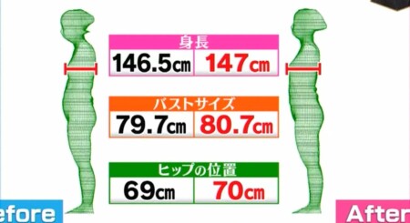 NHKあさイチ ファシアゆるゆる体操でバストアップ、ヒップアップ 2段階のファシアケアで腰痛・膝の痛み改善の詳しいやり方、新常識は？