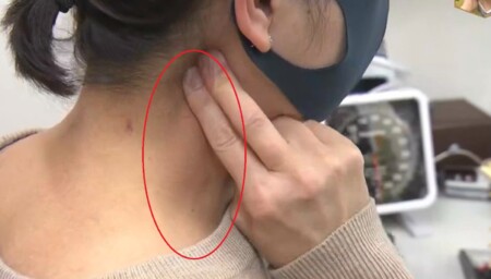 NHKあさイチ マスク不調改善SP マスク頭痛は2タイプに分けて改善！緊張型頭痛のセルフケア 耳の後ろ