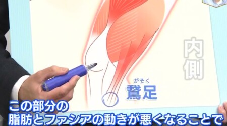 NHKあさイチ 膝の痛みは鵞足のファシア 2段階のファシアケアで腰痛・膝の痛み改善の詳しいやり方、新常識は？