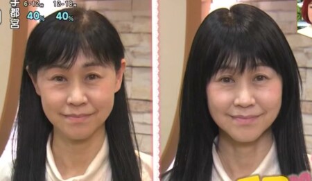 NHKあさイチ 女性の薄毛の原因と対策 薄毛専門美容院の髪型テクニック ウィッグで簡単に薄毛対策