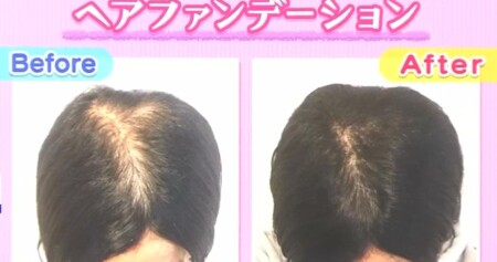 NHKあさイチ 女性の薄毛の原因と対策 薄毛専門美容院の髪型テクニック ヘアファンデーションで薄毛隠し