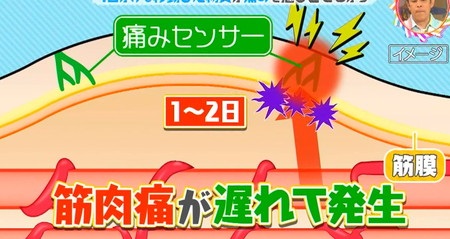 チコちゃんに叱られる 筋肉痛はなぜ翌日 答えは刺激物質の移動