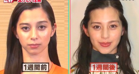 世界一受けたい授業 第2弾 奇跡の頭ほぐし 顔ほぐしのやり方まとめ 中条あやみも効果あり