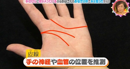 チコちゃんに叱られる 手の平の線(手相)は医学的には皮線と呼ばれる