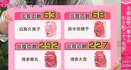 あさイチ シミ対策特集 ゲストやレギュラー出演者の顔の炎症比較