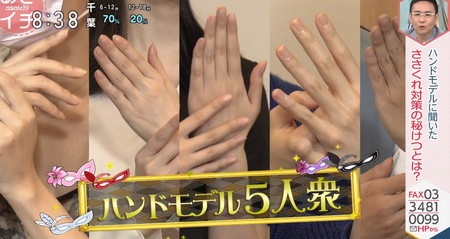 あさイチ ささくれの原因と治し方 ハンドモデルのささくれケア方法は