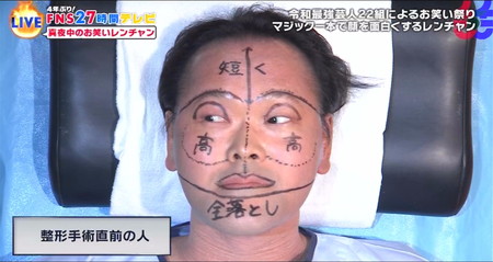 27時間テレビ マジック一本グランプリ アインシュタイン稲田 整形手術直前の人