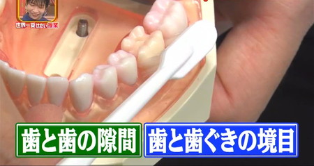 世界一受けたい授業 歯周病は歯磨きとフロスで治る？歯間、歯茎の磨き方