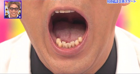 錦鯉長谷川の歯の治療 ロンハー